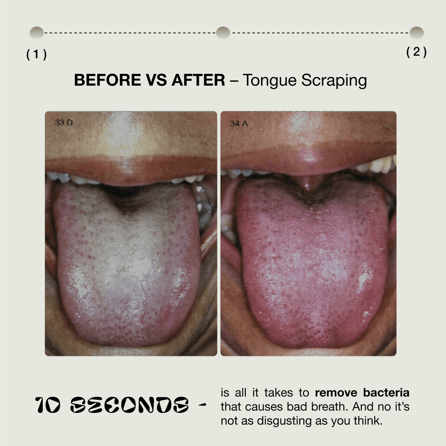 Before and after KÖPPEN copper tongue scraper